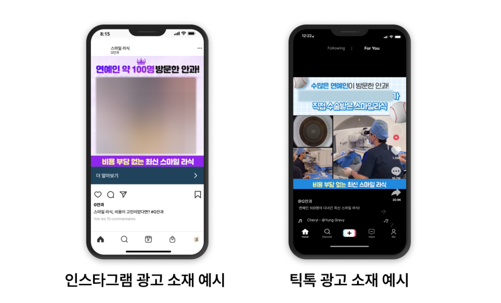 안과 광고 소재 에시