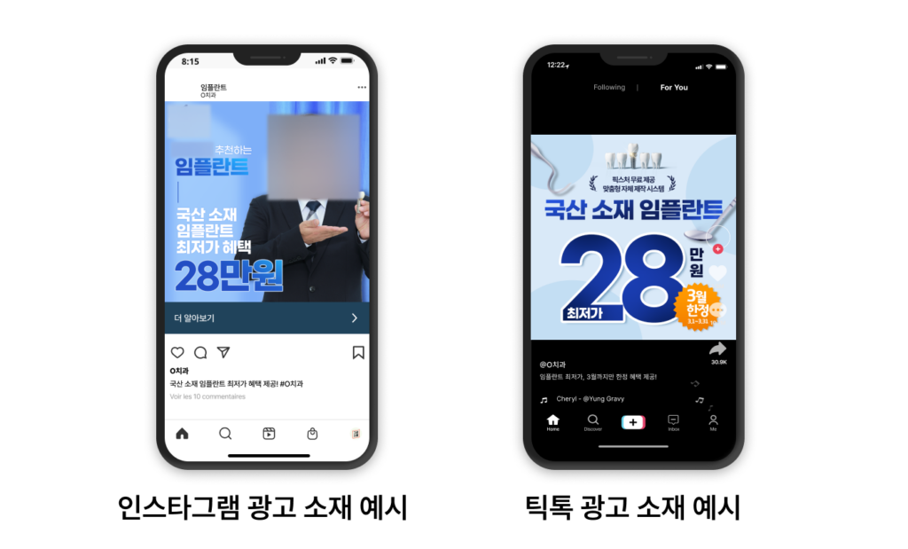치과 광고 소재 예시